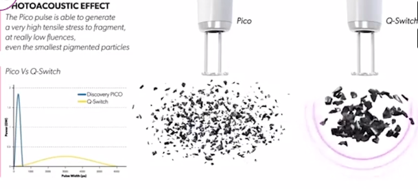 The science behind pico laser tattoo removal