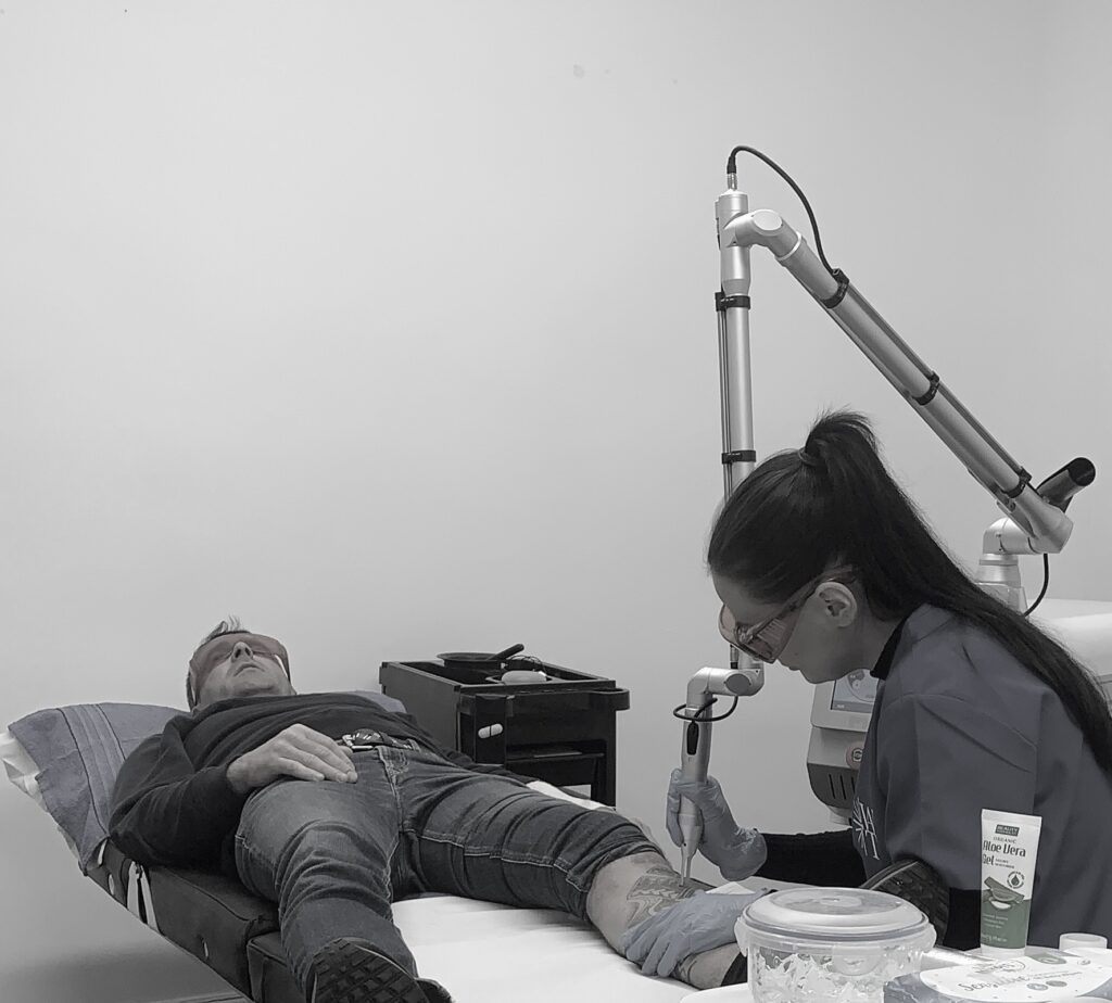 The science behind pico laser tattoo removal