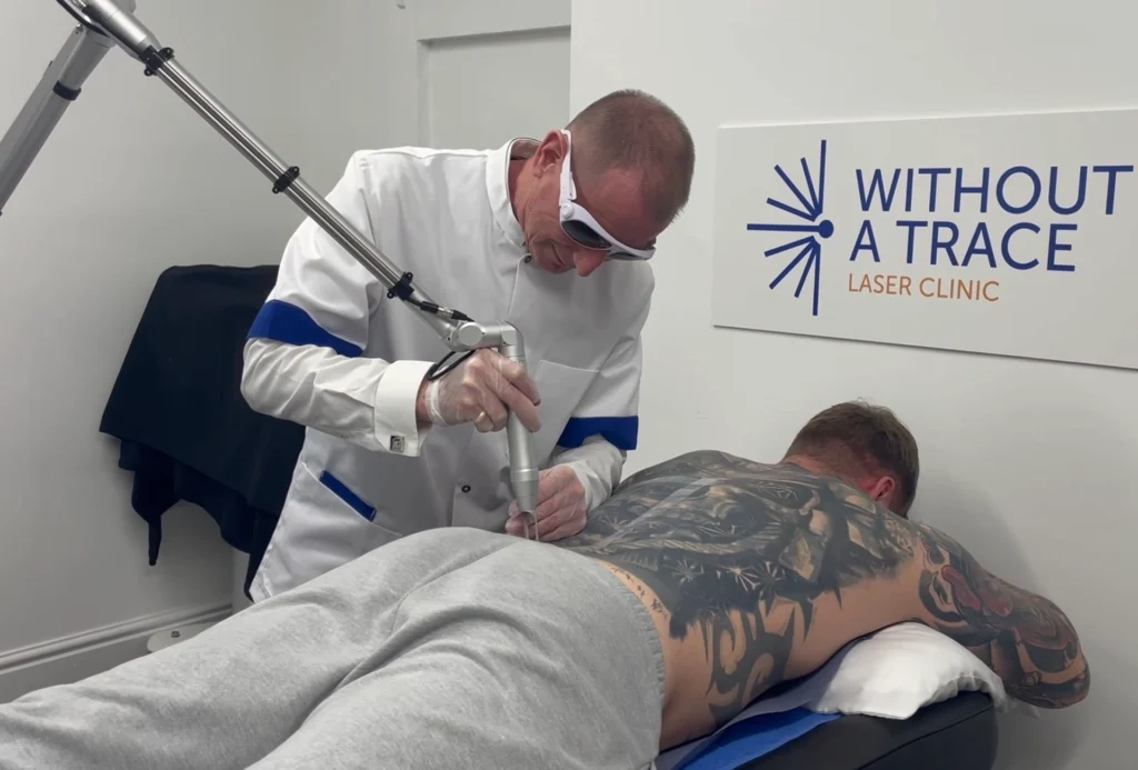 The Science Behind Pico Laser Tattoo Removal